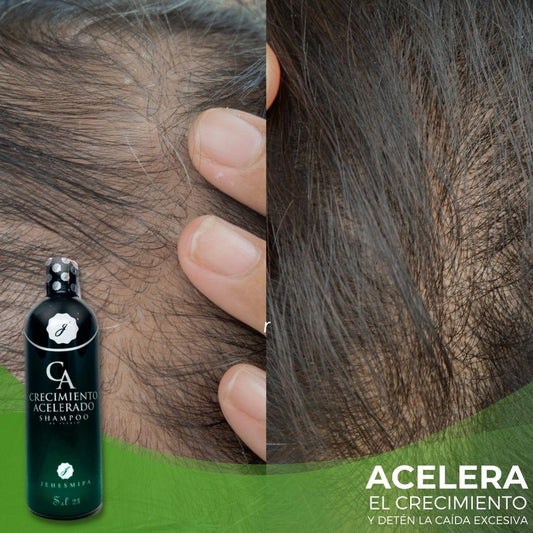 SHAMPOO CRECIMIENTO ACELERADO + OBSEQUIO (PERFUME CAPILAR) (Cópia)